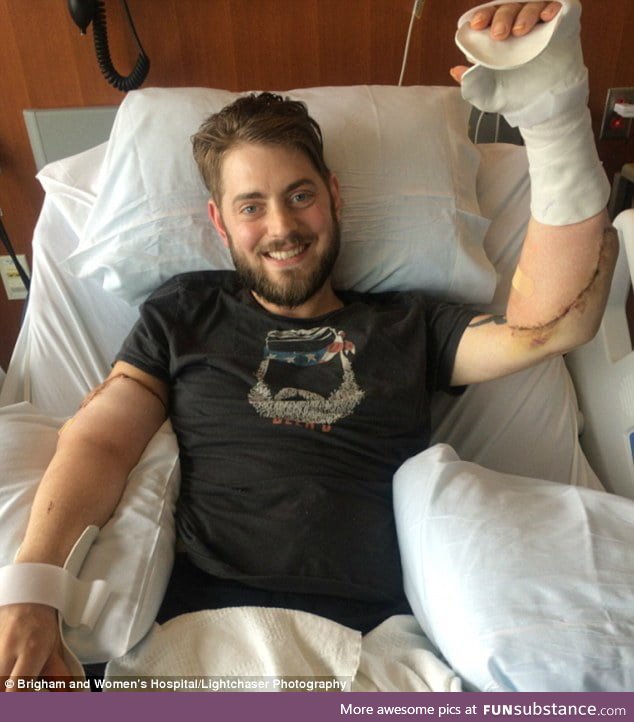 Former Marine receives double arm transplant after losing all four limbs to homemade bomb