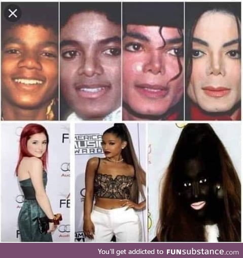 It's reverse vitiligo for her