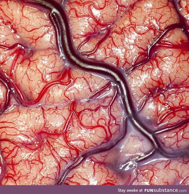 Picture of a living brain. Taken by Robert Ludlow during surgery