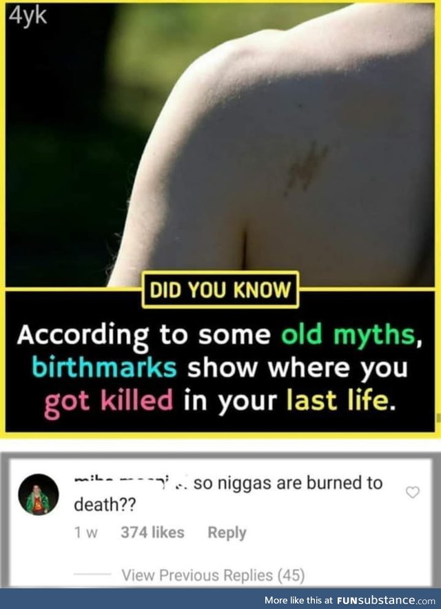 But I don't have birthmark