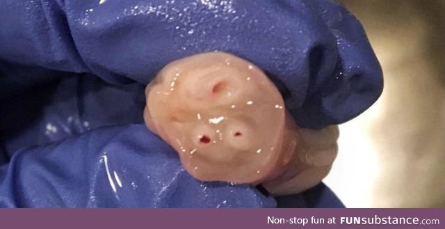 TIL: The umbilical cord has one vein that feeds babies with the nutrients they need from