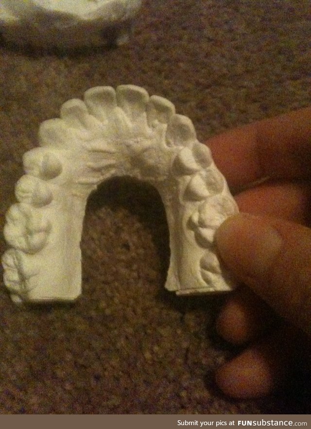 Top jaw after.