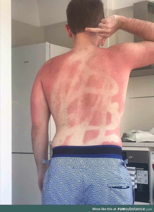 Asked my friend to put sunscreen on my back. She had one job. She failed