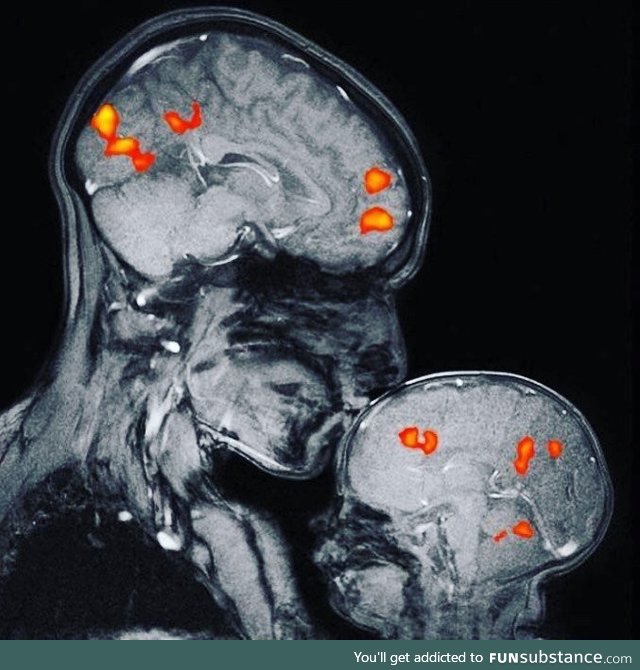 Magnetic resonance image showing a mother and child’s bond. The image is of
