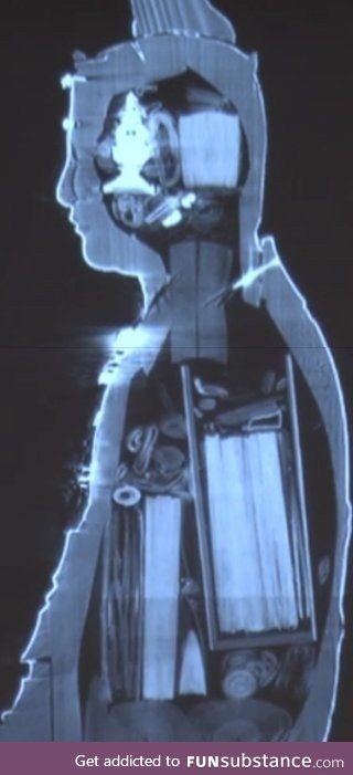 The X-ray of an ancient Buddhanese statue