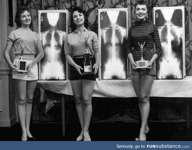 Winners of the Miss Beautiful Spine contest, cervical 1956