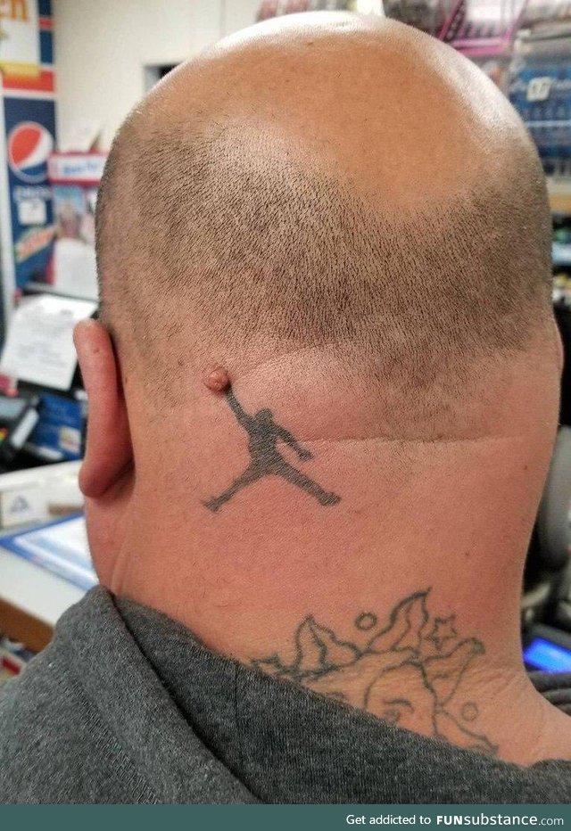 Hiding wart with a tatoo? Say no more