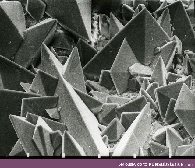 A kidney stone under an electron microscope