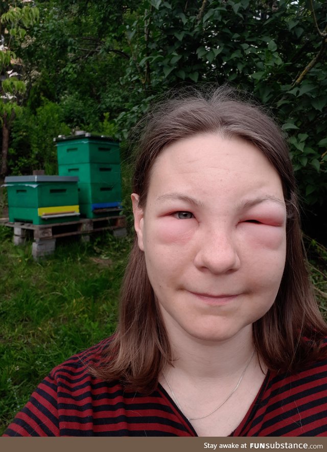 Should have worn a veil when checking on my bees