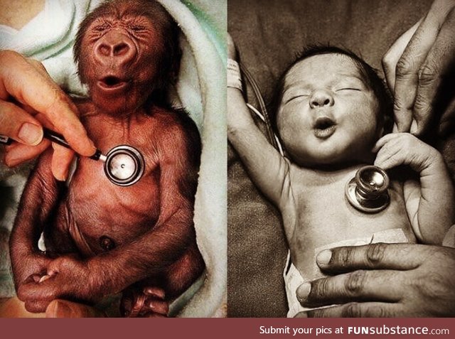 Baby human and baby gorilla reaction to a cold stethoscope