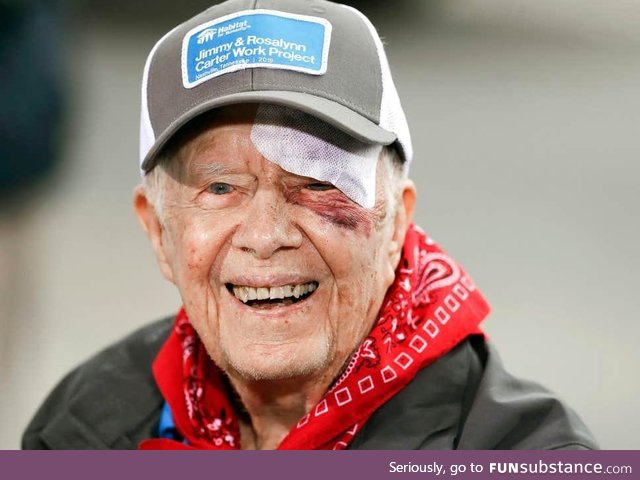 Nothing seems to slow Jimmy Carter down. After beating cancer, 14 stitches and a black