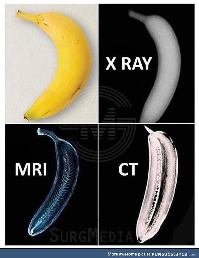 Banana for scan