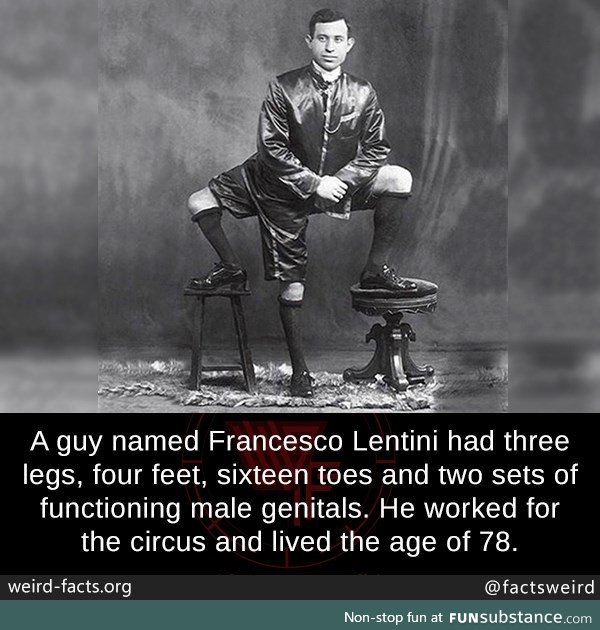 How did this three-legged man work?