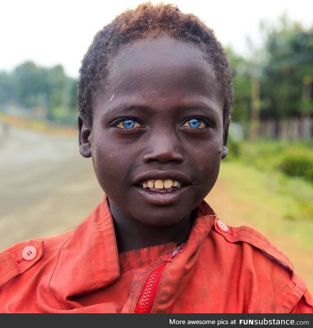 Ethiopian boy with blue eyes