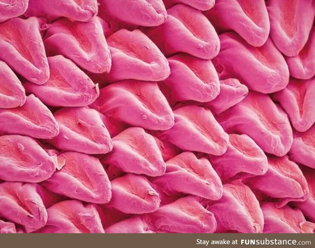A cats tounge underneath a Electron Microscope