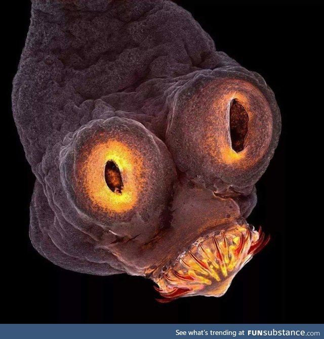 The head of a tapeworm