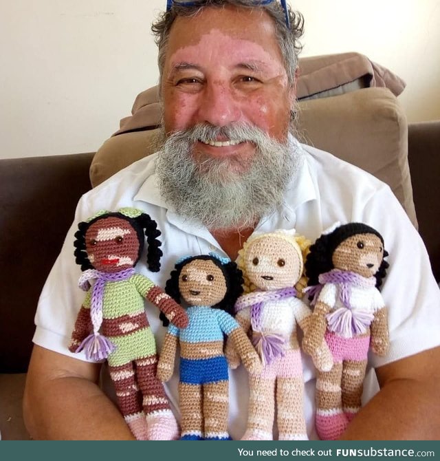 This Grandfather with Vitiligo crochets Dolls for Children with the Condition