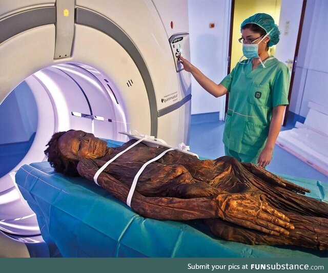 Patient burned alive after failed MRI