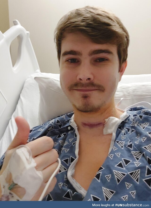 Got a full thyroidectomy on my right side for a cancerous nodule