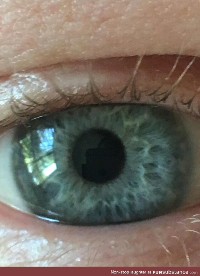 My eye has a screaming face in it