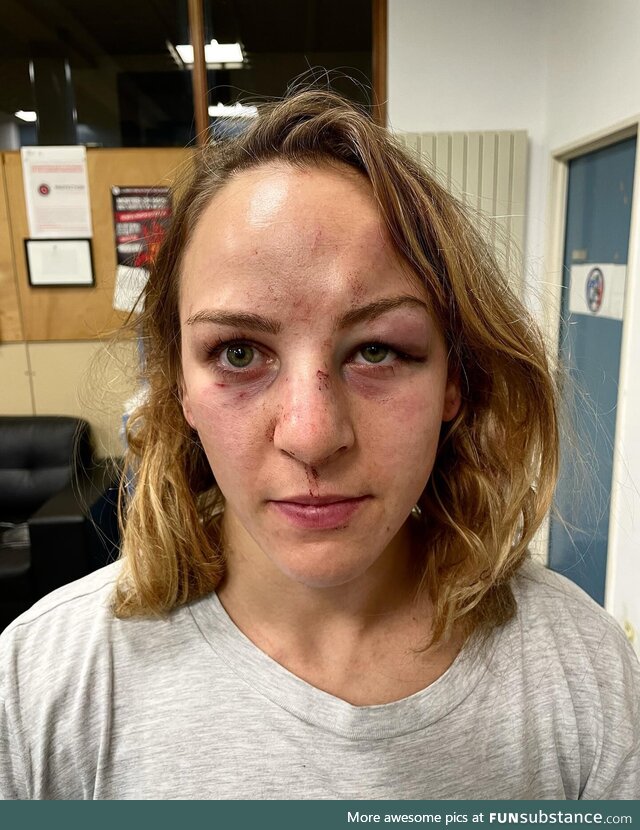 Margaux Pinot posted her picture after being attacked by her partner - he was released