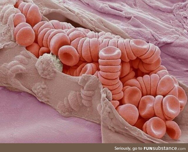 Ruptured venule under the scanning electron microscope
