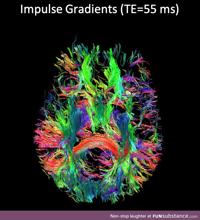 The complex circuitry of the brain captured by a new M.R.I. Scanner that has a resolution