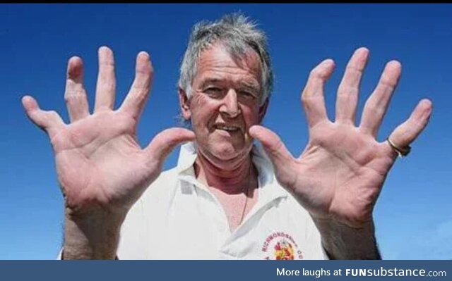 David Morrison's hands after playing as a wicketkeeper-batsman for 45 years