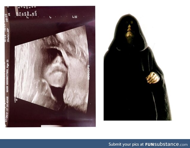 Latest ultrasound confirmed baby is indeed a Sith Lord