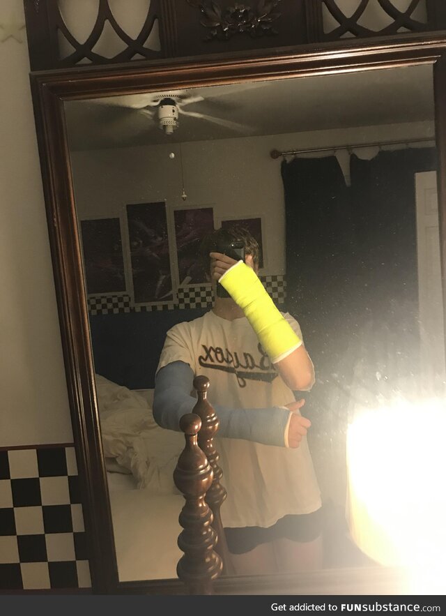 Broke both of my arms yesterday