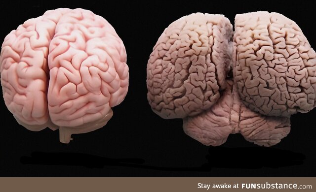 A human brain on the left, a dolphin brain on the right