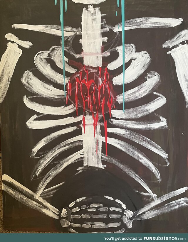 I just had a miscarriage. I didn’t know how else to express my pain. Sorry for the poor
