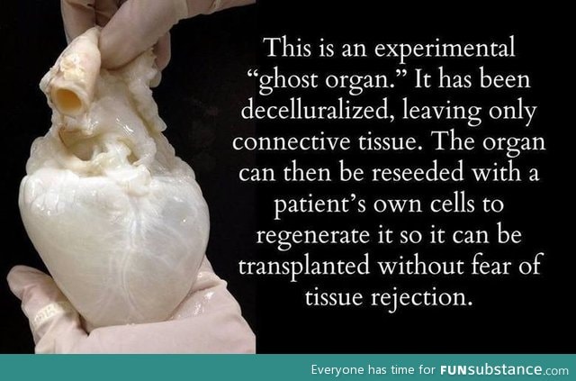 Did you hear we can 3D print organs now?