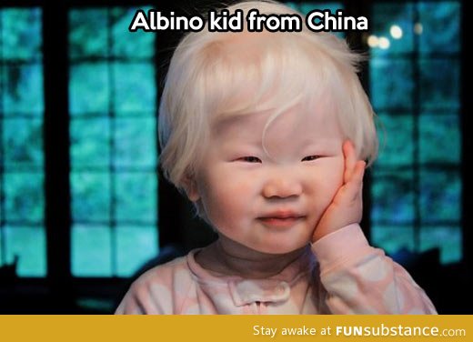 An albino kid from china