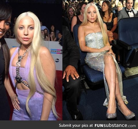 So lady gaga decided to dress normal