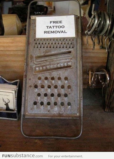 Tattoo Removal