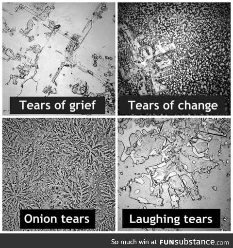 Tears under a microscope