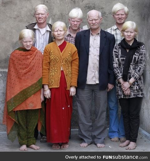 Albino Family from India