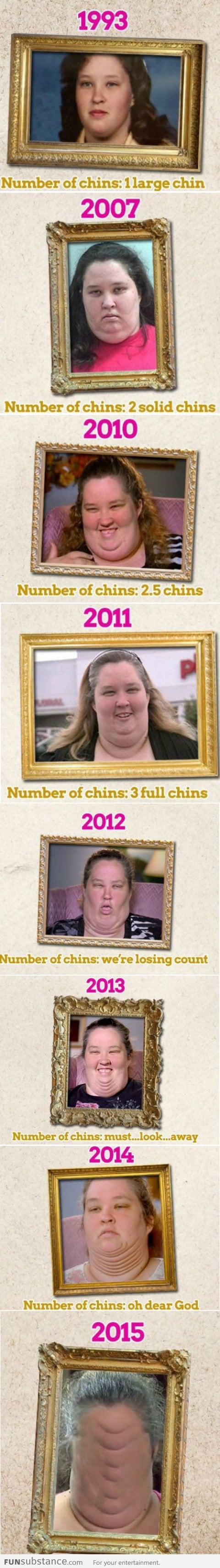 Forever growing new chins