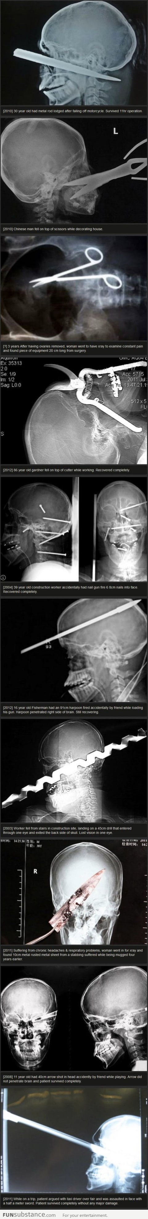 10 Most Bizarre X-Rays