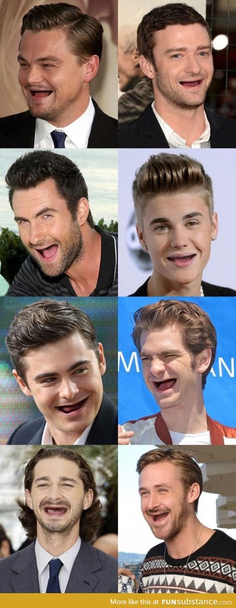 When celebrities don't have teeth, you should take care of them