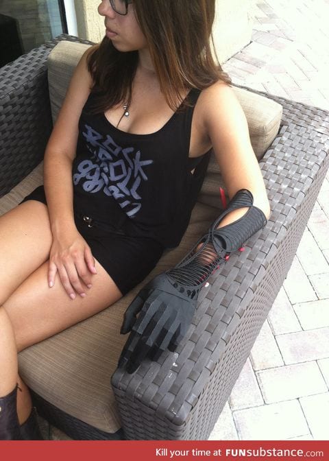 3D printed Prosthetic arm