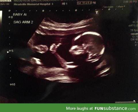 Recent ultrasound result looks good