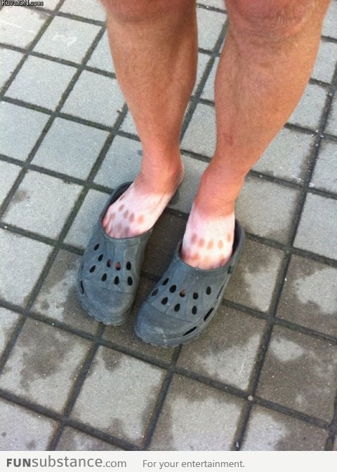 that's what you get for wearing crocs