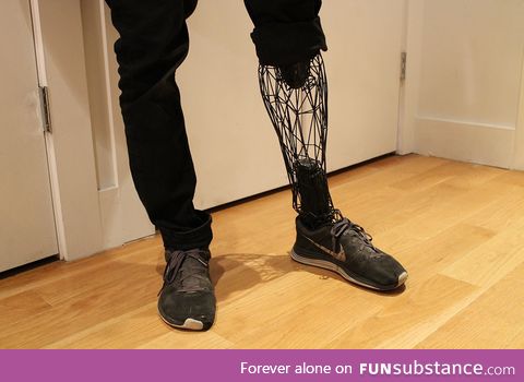 3D printed prosthesis