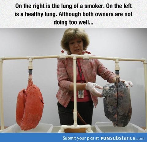 The lung of a smoker and a healthy lung