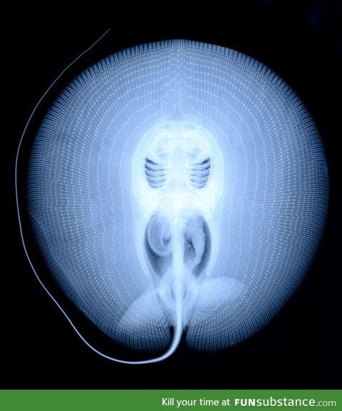 X-Ray of a Stingray