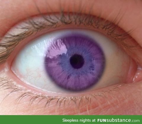 This is the Alexandria's Syndrome of the violet eyes!