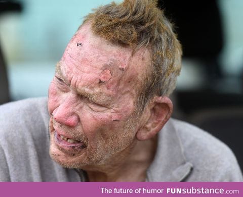 This hero is 82 year old Perry Boore. He was severely burned while trying to rescue dogs
