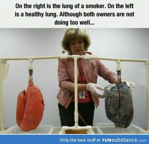 Heathy Lung and Smoker Lung